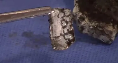 Metalni implantant