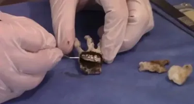Istraživači otkrili misteriozni implantant u "vanzemaljskoj mumiji" iz Perua